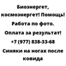 Синяки на ногах после ковида