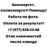 Отек конечностей после ковида