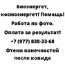 Отеки конечностей после ковида